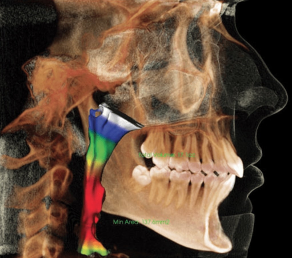 Quad City Orthodontics in Bettendorf, IA, Rock Island and Geneseo, IL